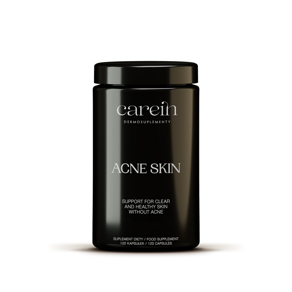Acne Skin
